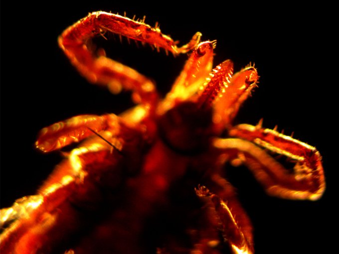 Lyme disease